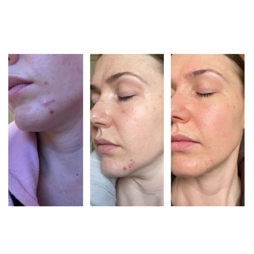 Customer photo review of Youth Boost