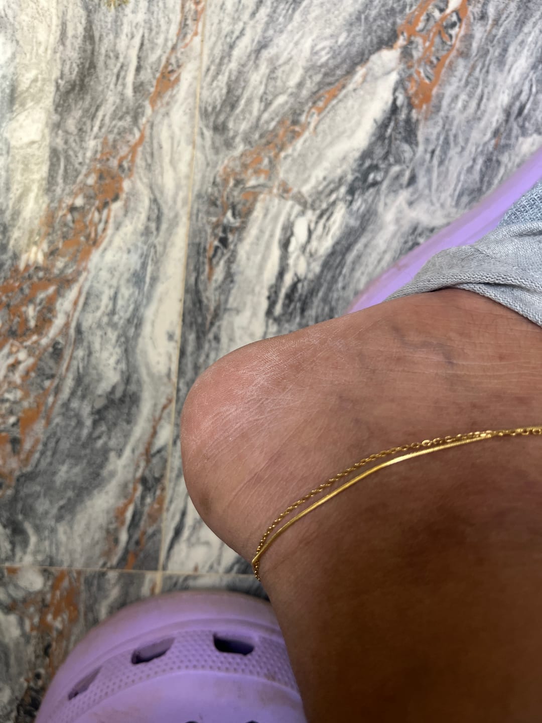 Customer photo review of Two Layered Solid Cable Anklet