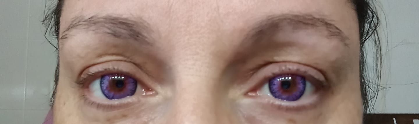 Customer photo review of Vega Violet Purple Prescription Coloured Contact Lenses
