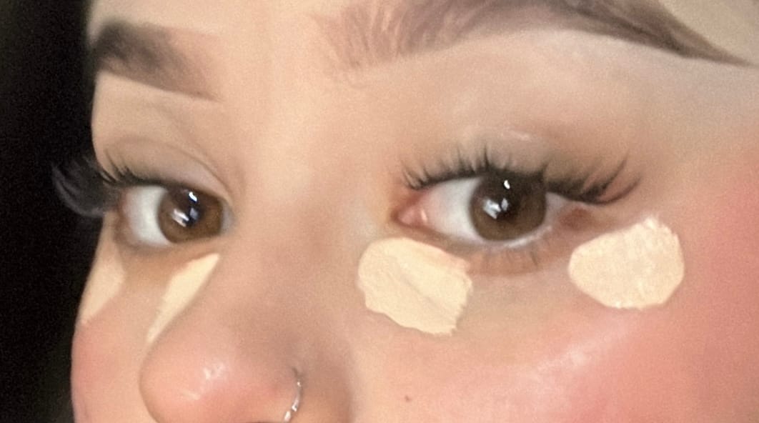 Customer photo review of Hydrating Camo Concealer