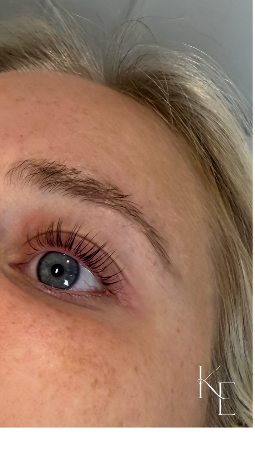 Customer photo review of Hypoallergenic Reusable Eye Pads