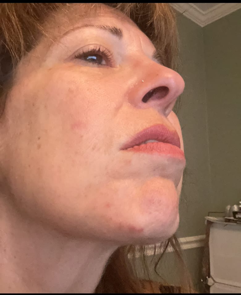 Customer photo review of Painless Facial Hair Removal Cream