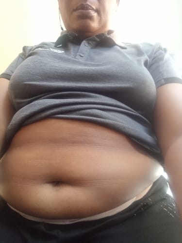 Customer photo review of Fibroid & Hormonal Balance Combo