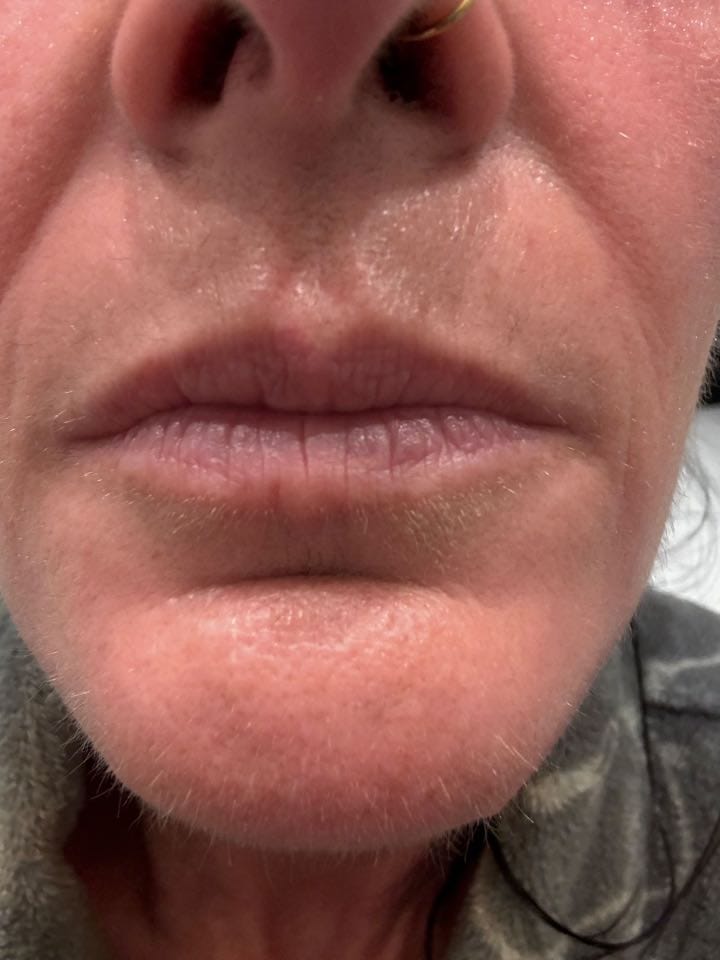 Customer photo review of Painless Facial Hair Removal Cream