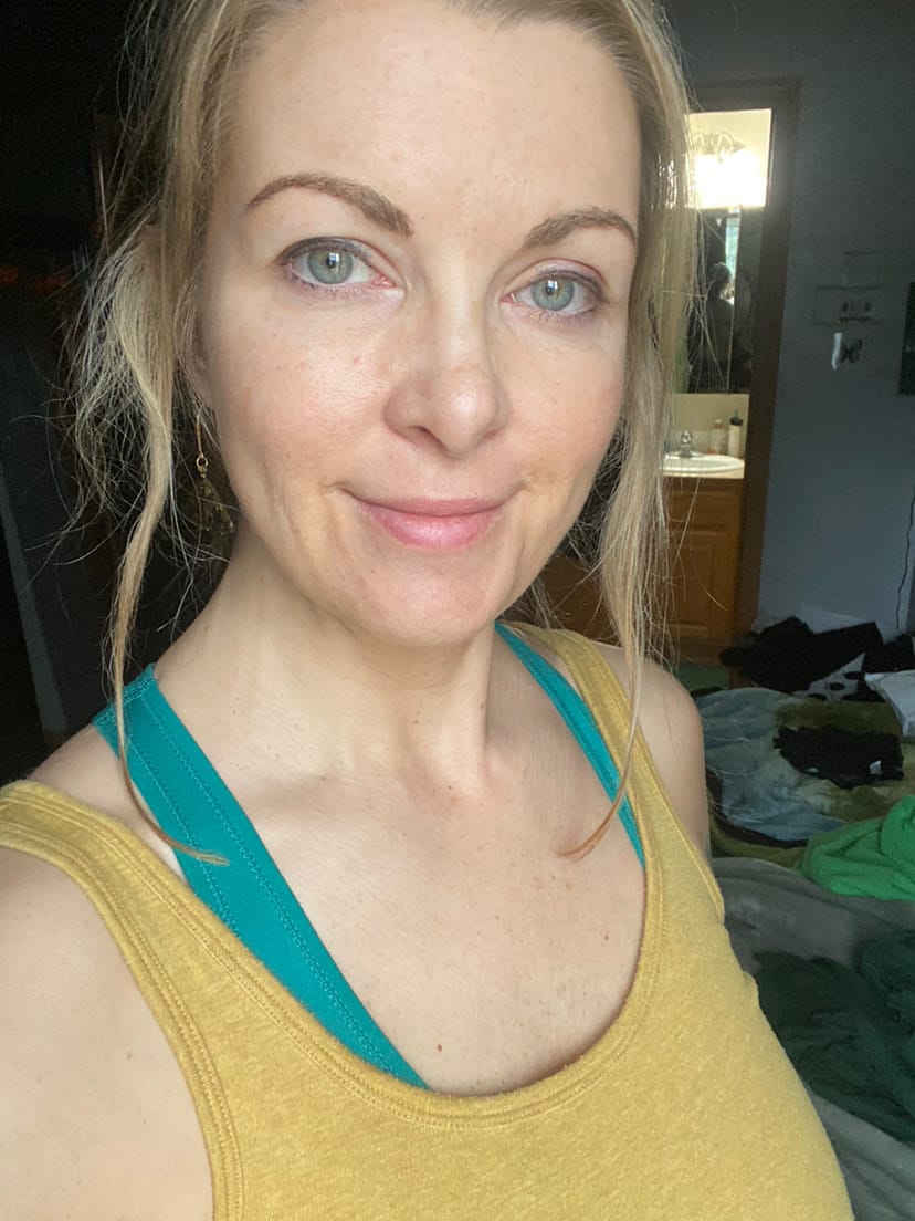 Customer photo review of Painless Hair Removal Cream