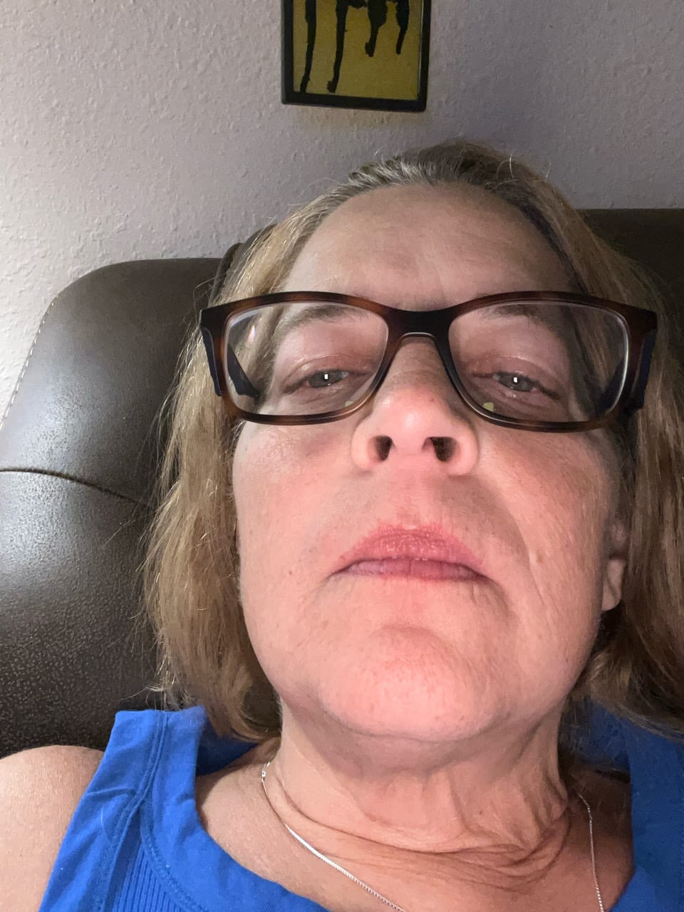 Customer photo review of Painless Hair Removal Cream