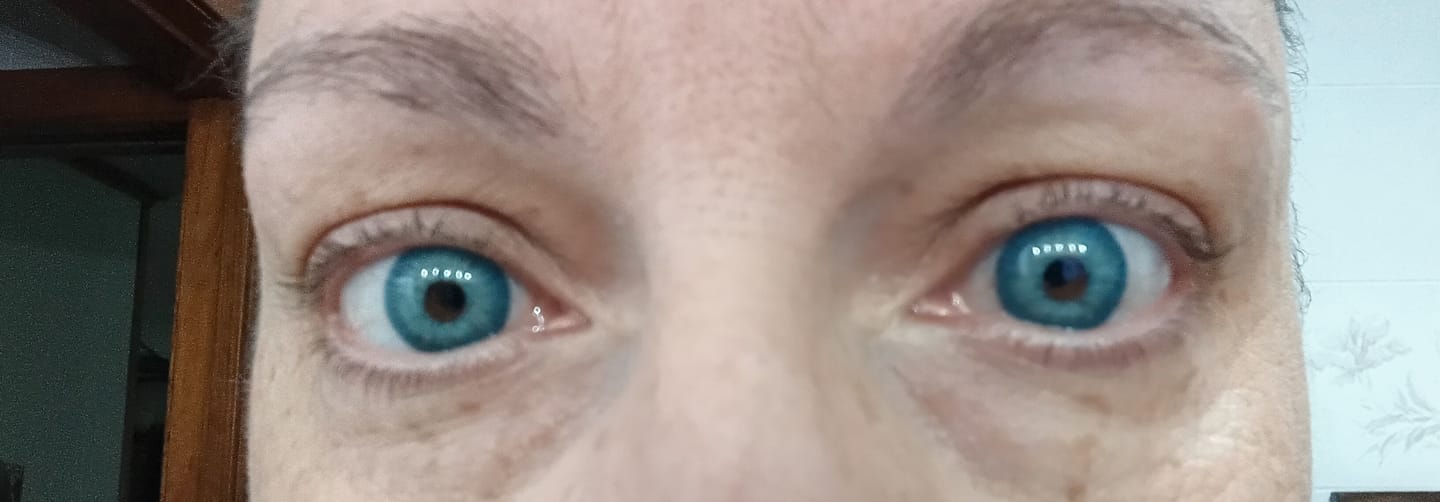 Customer photo review of Amazonia Antarctic Blue Prescription Colored Contact Lenses