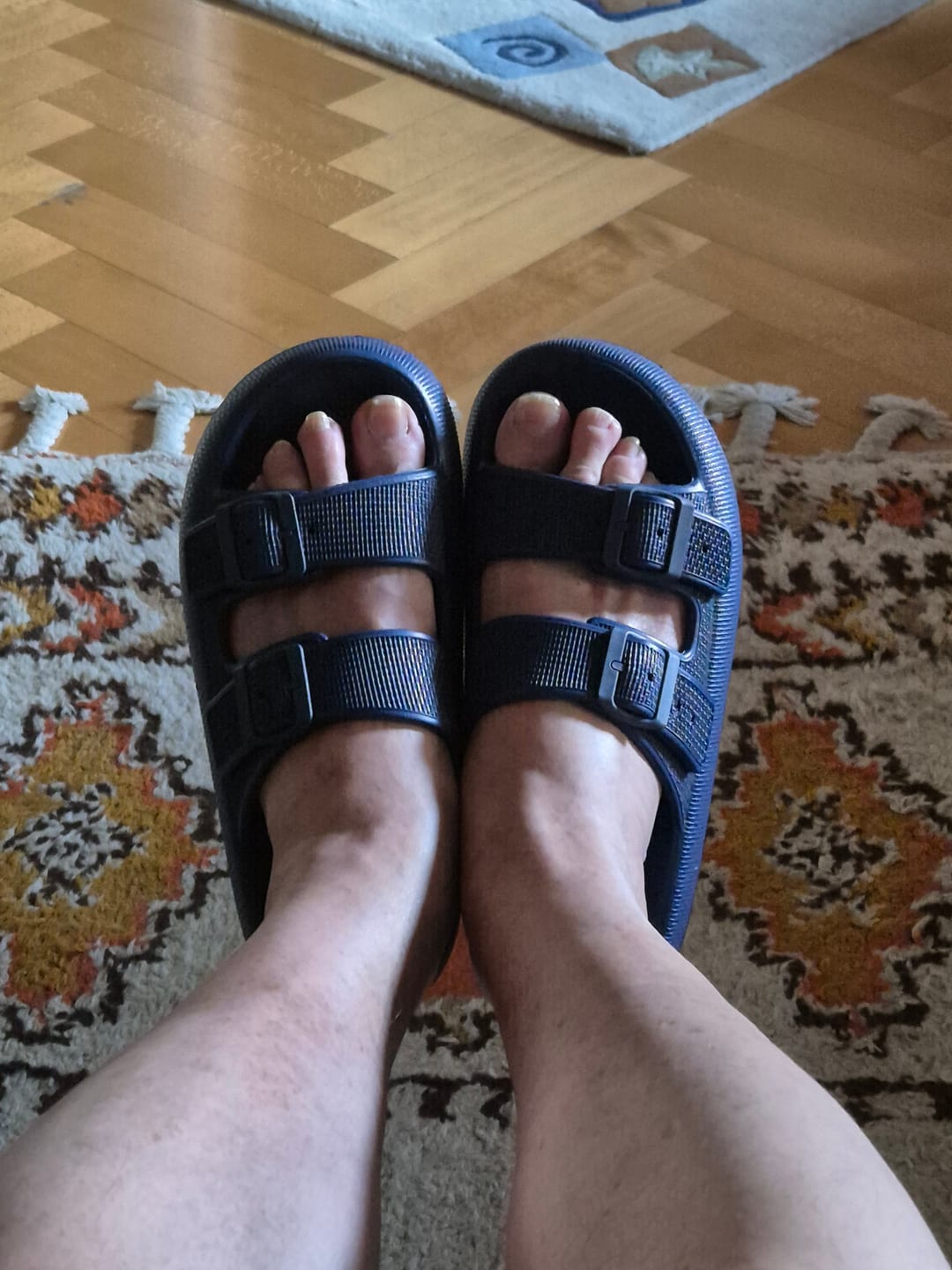 Customer photo review of Pantoufle Orthopédique Cloudly™ 2