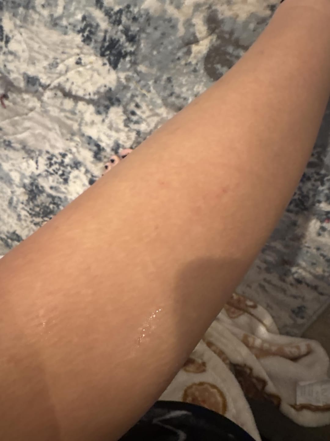 Customer photo review of Painless Hair Removal Cream