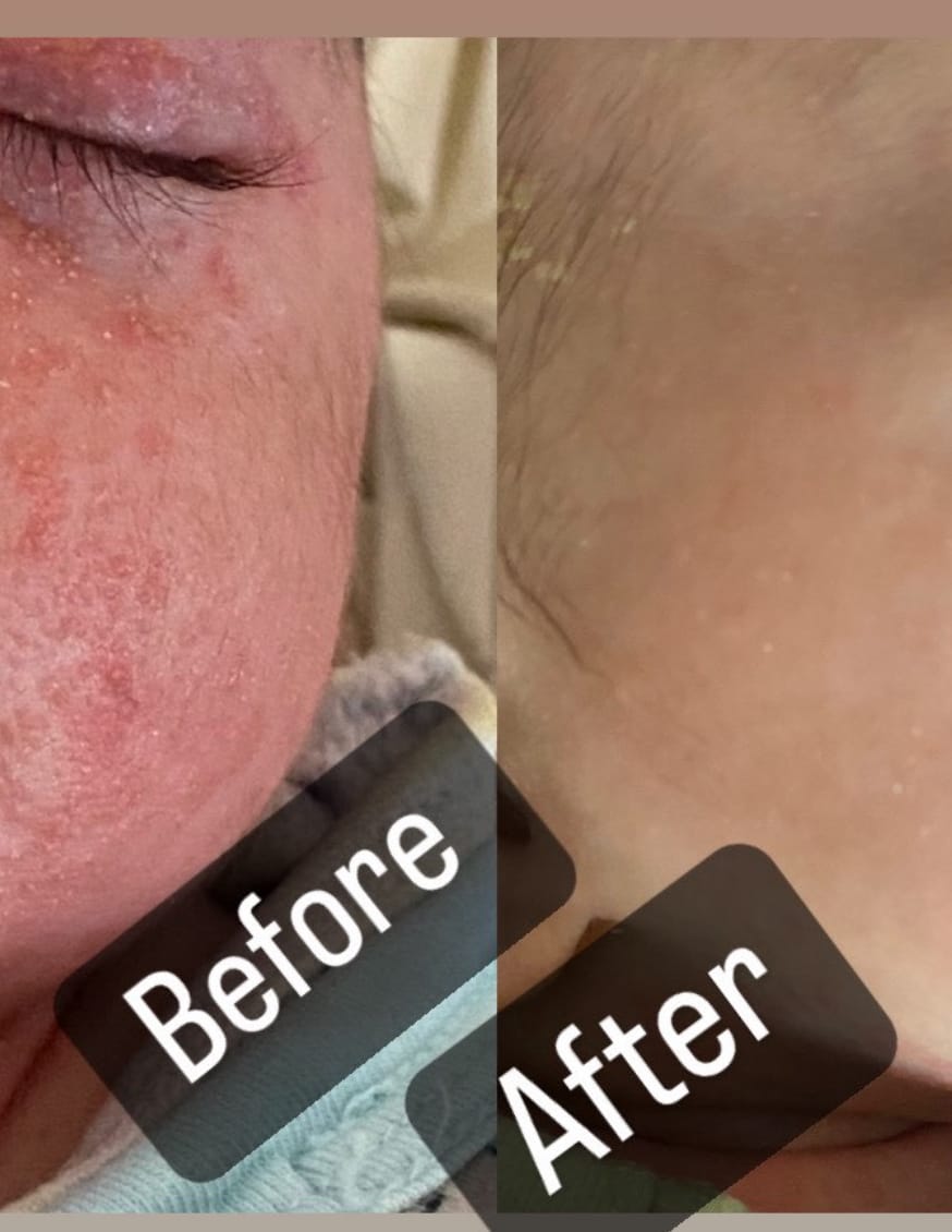 Customer photo review of Organic Barrier Balm 90g