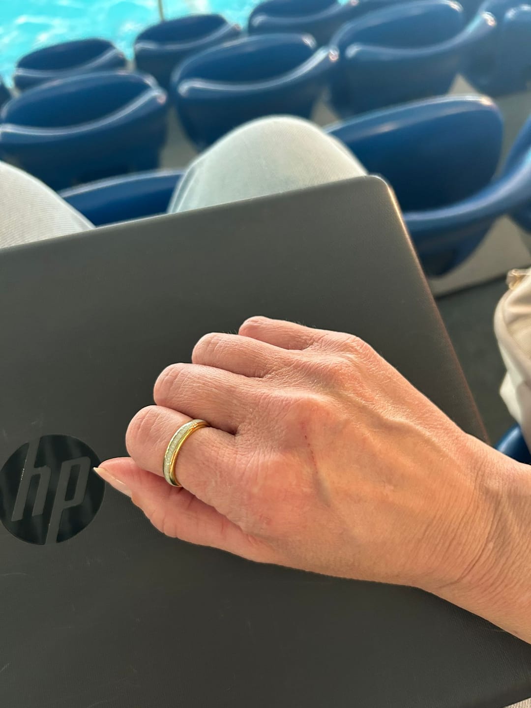 Customer photo review of The Golden White Opal Wonder Ring Set