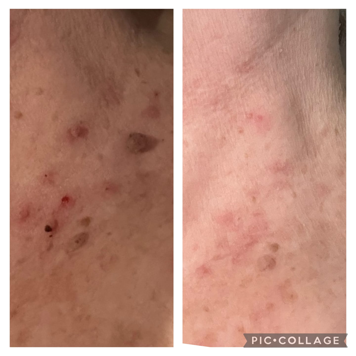 Customer photo review of MAGNESIUM SUPER STICK