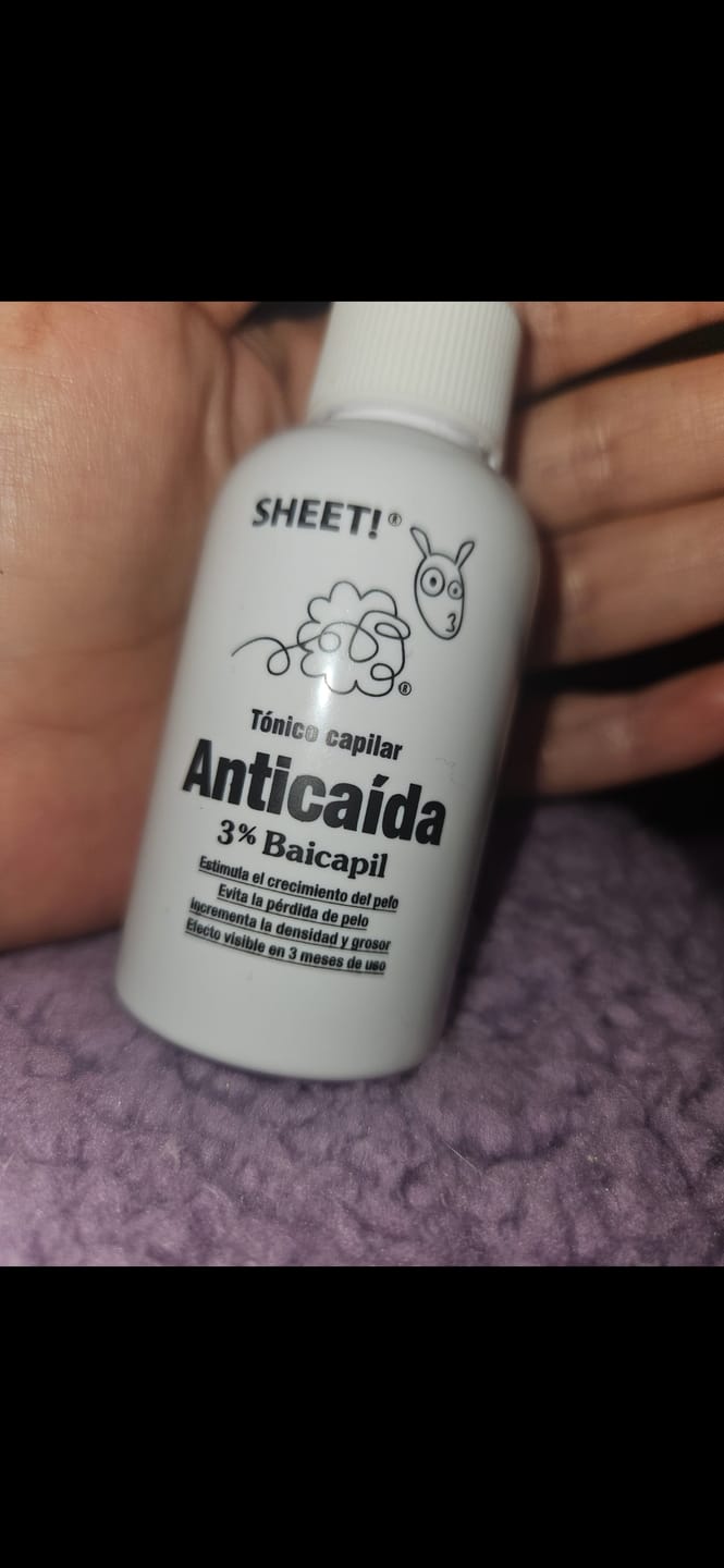 Customer photo review of Pack Anticaída de Cabello para 3 Meses