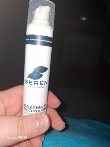 Customer photo review of SERENI Pikkelysömör és Ekcéma Krém