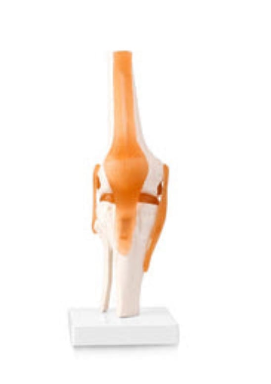 Customer photo review of Articulación de Rodilla