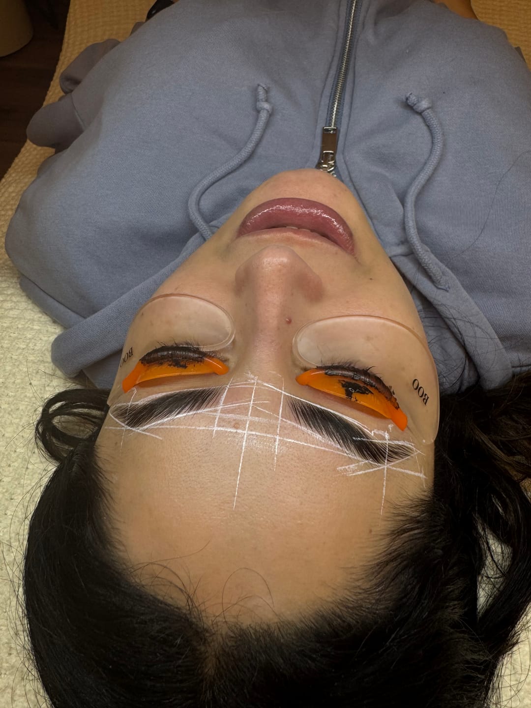Customer photo review of Hypoallergenic Reusable Eye Pads