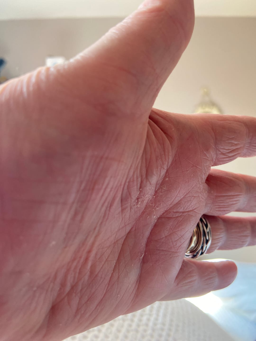 Customer photo review of Bioskin Duo Pack