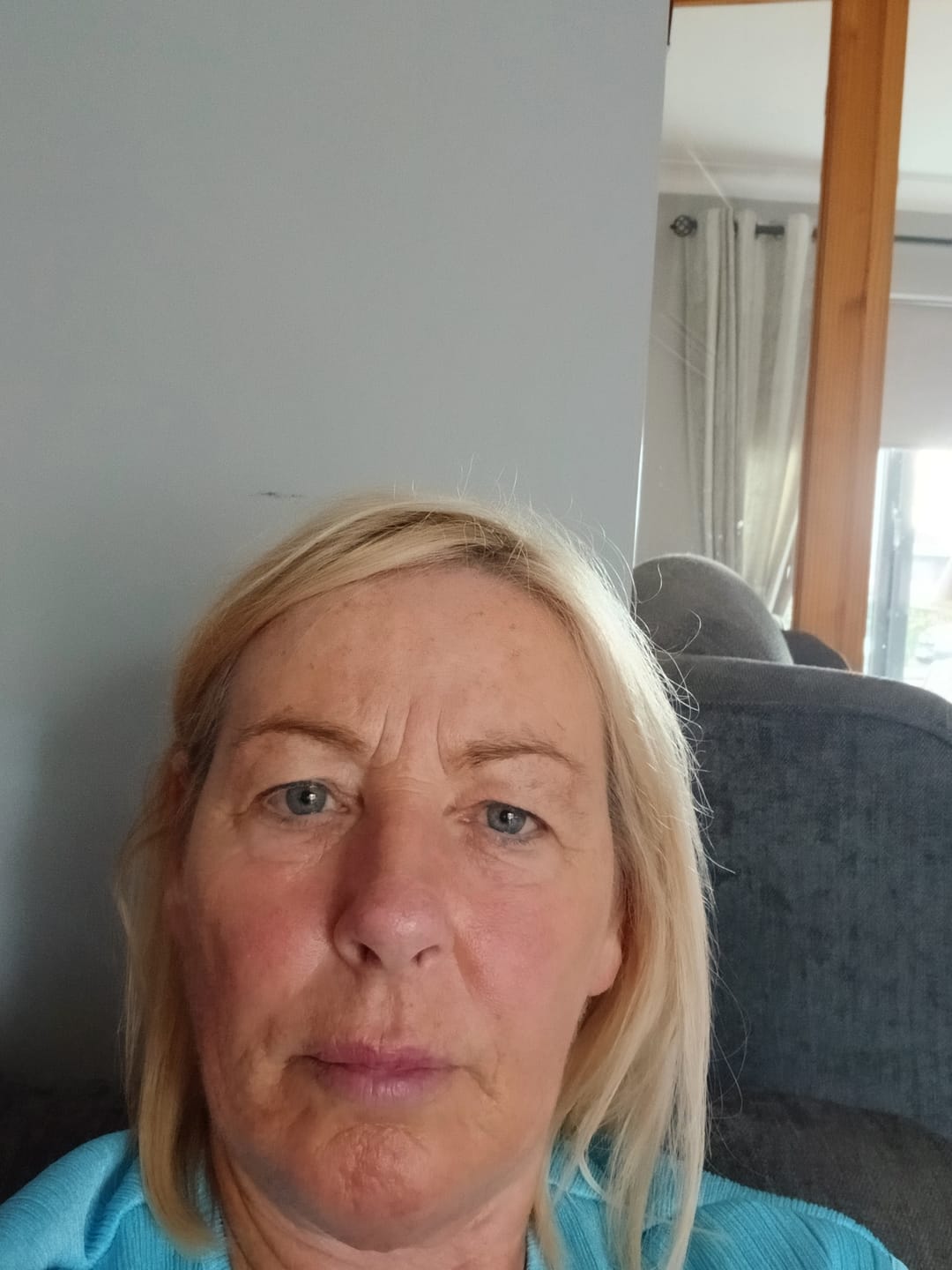 Customer photo review of Rosalique 3 in 1 Anti-Redness Miracle Formula SPF50