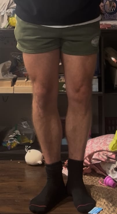 Customer photo review of Vintage Cotton Shorts | Green