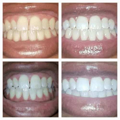 Customer photo review of Pro Glow™