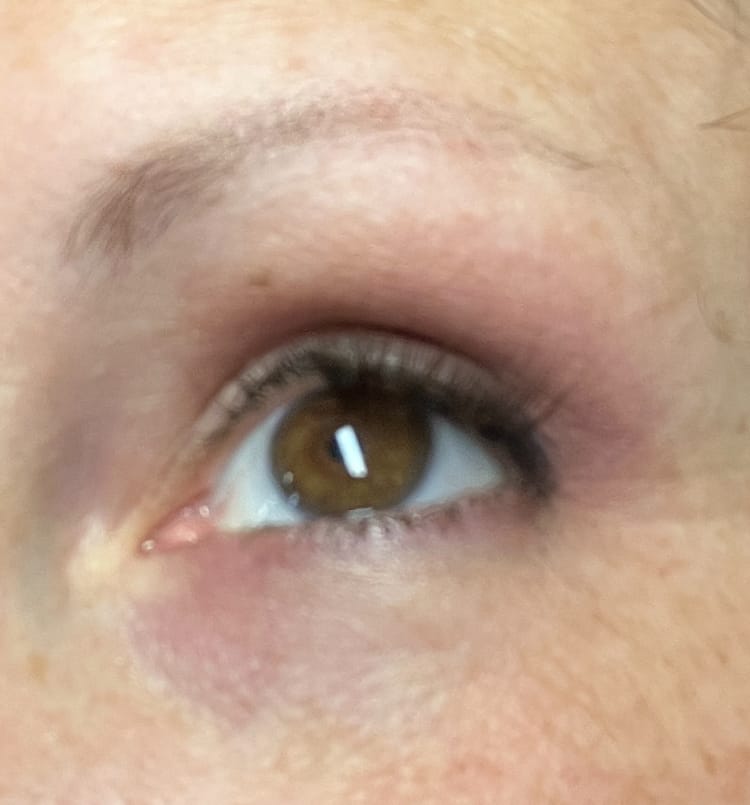 Customer photo review of Beauty