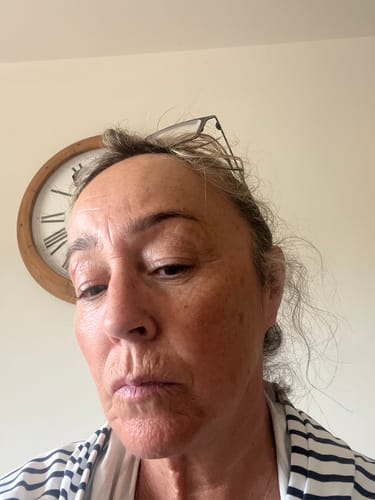 Customer photo review of SEA BUCKTHORN SERUM