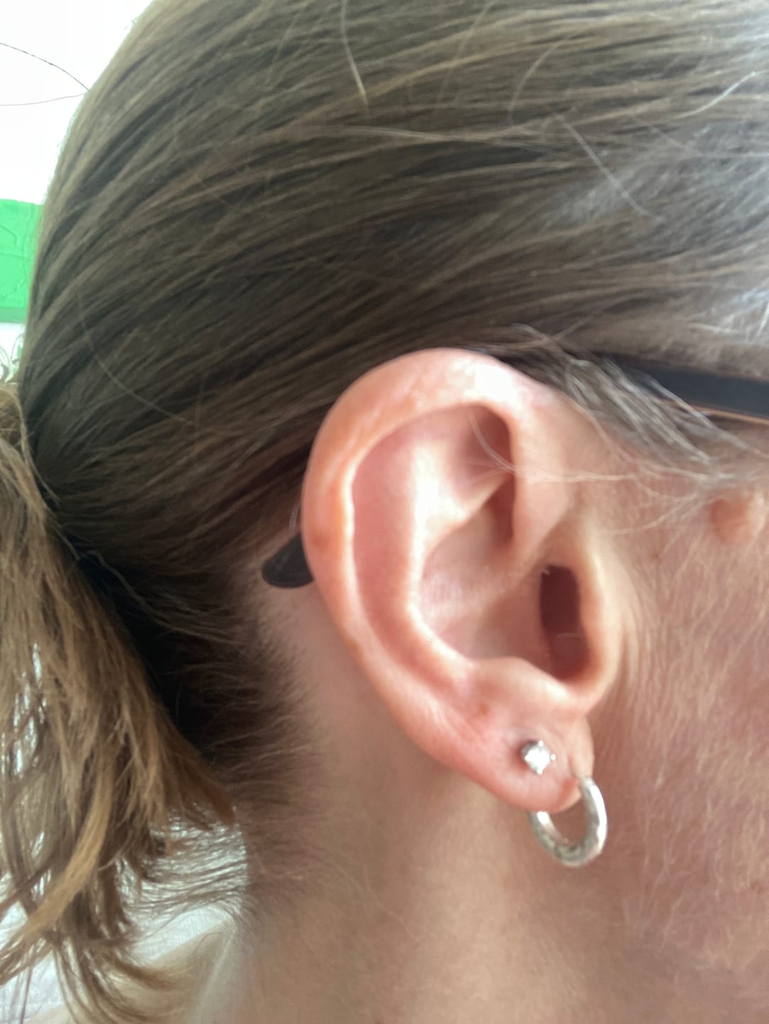 Customer photo review of World's First Lab Grown Diamond Sleep Stud Earrings