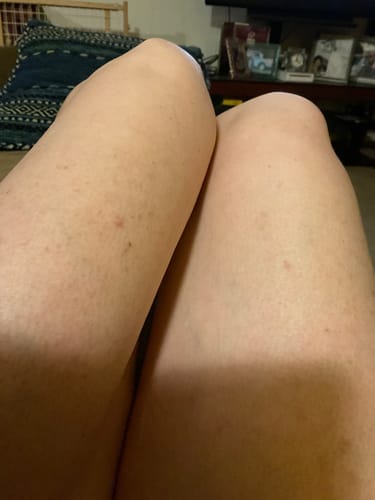 Customer photo review of Besque™ Magic Body Oil - 100ml