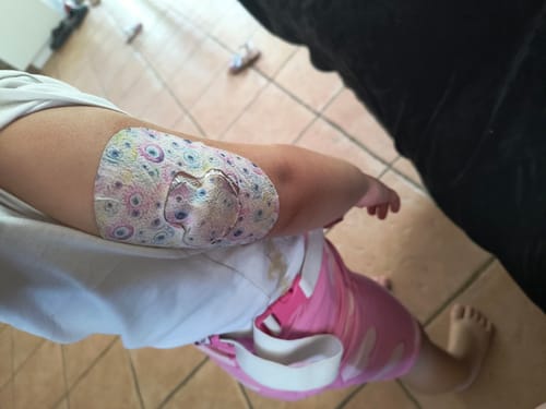 Customer photo review of Guardian Enlite Patches - Patch Me UP! Spring