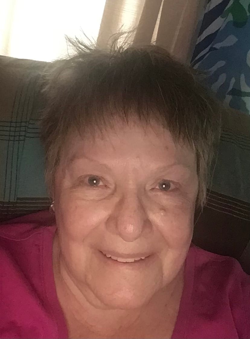 Customer photo review of Pain Away Gel 1000MG
