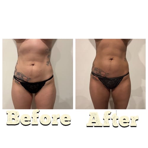 Customer photo review of Senza Sole Premium - Professional Solution