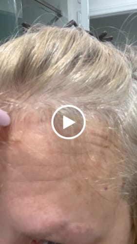 Customer video review of Enrich Hair Growth Oil