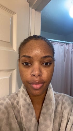 Customer photo review of Discoloration Brightening Corrector