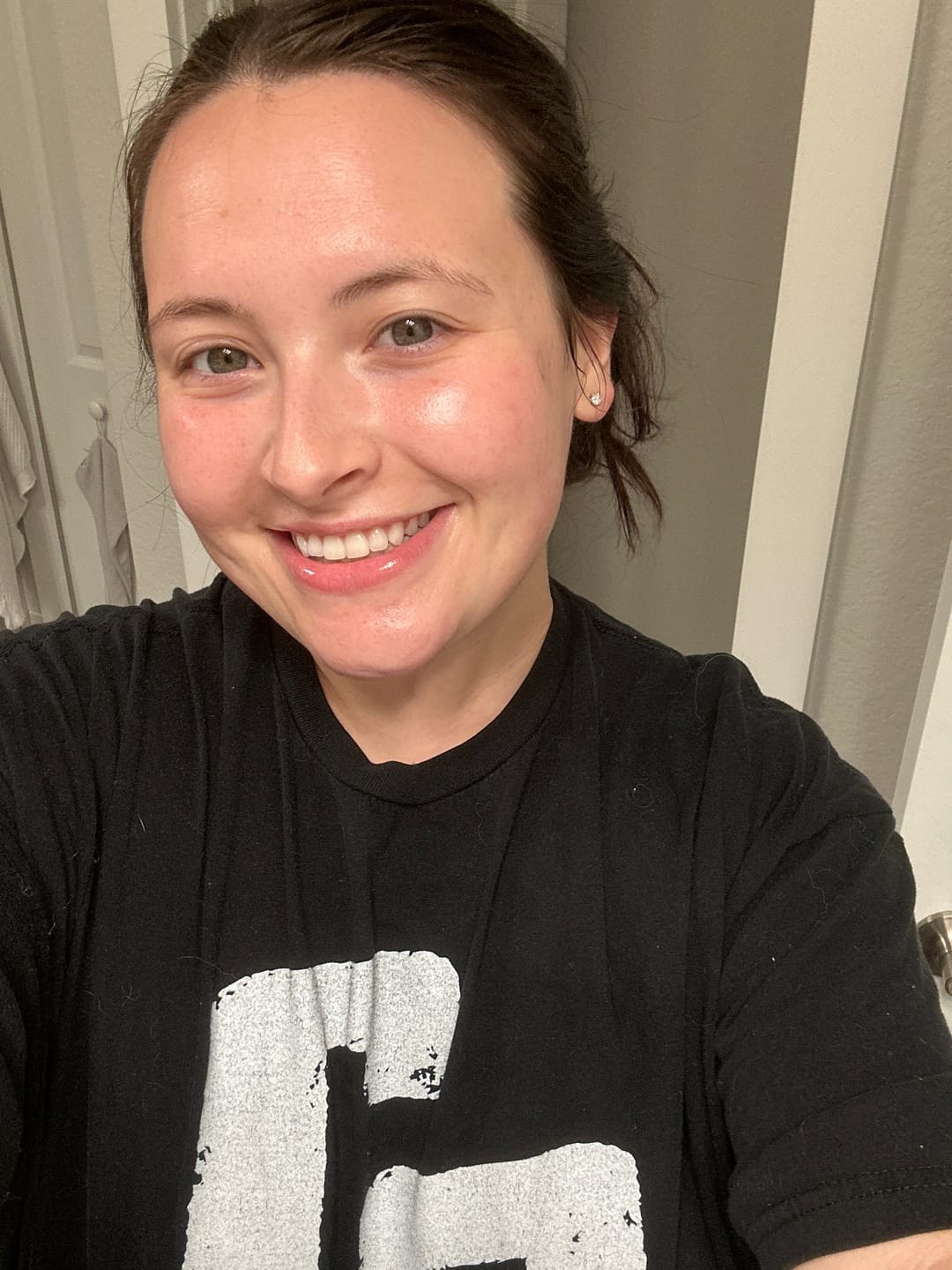Customer photo review of hyaluronic serum | plumping + hydrating + smoothing