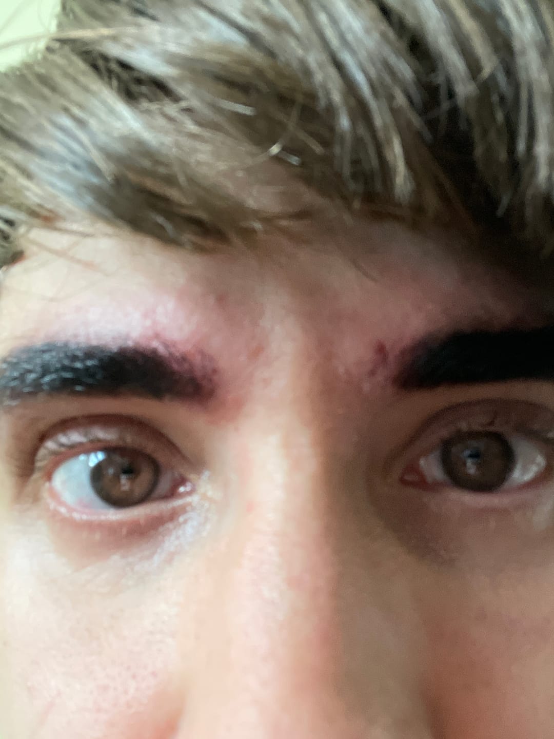 Customer photo review of Eyeling Custom Lens (1 month)