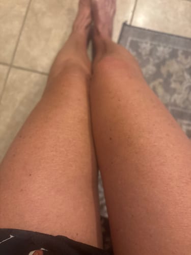 Customer photo review of Besque™ Magic Body Oil - 100ml