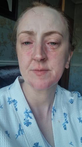 Customer photo review of MYLASMOSS SEAMOSS GEL (340ML)