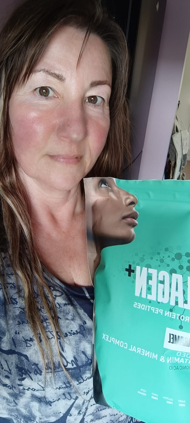 Customer photo review of Collagen Peptide Protein Powder