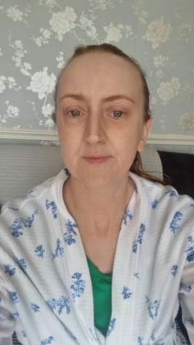 Customer photo review of MYLASMOSS SEAMOSS GEL (340ML)