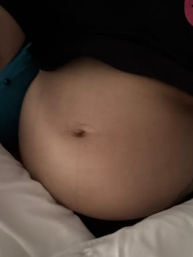 Customer photo review of (Restocked!)TROPICAL DRAGON scalp and body BUTTER 4oz & 6oz