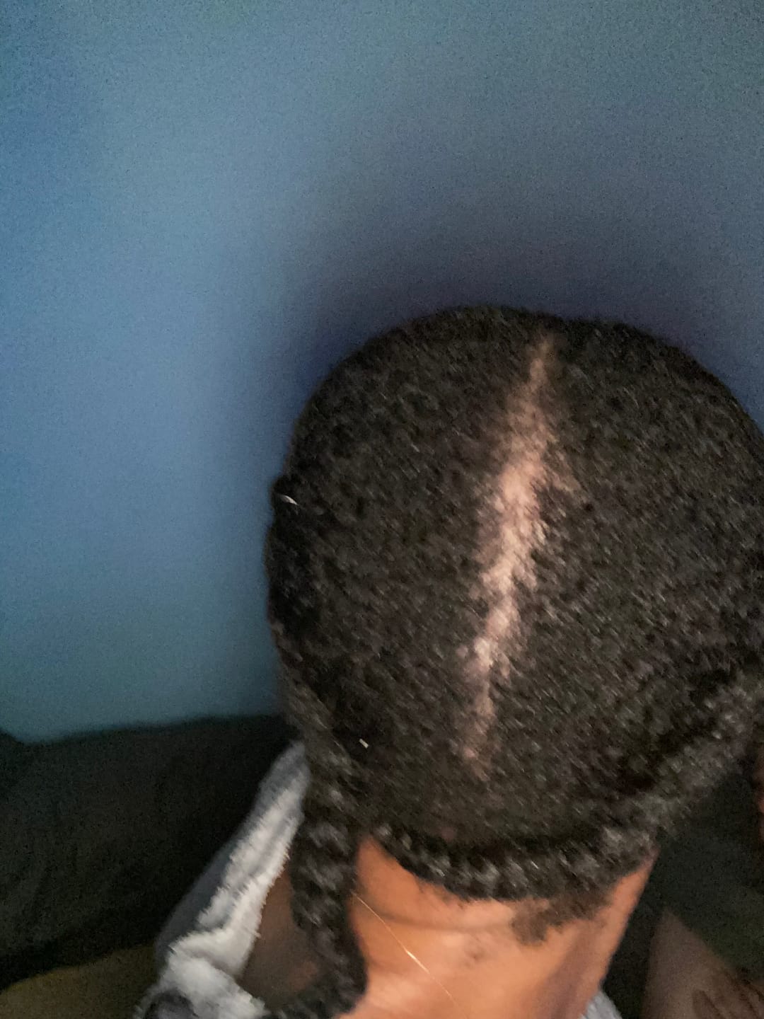 Customer photo review of DHT Blocking Shampoo