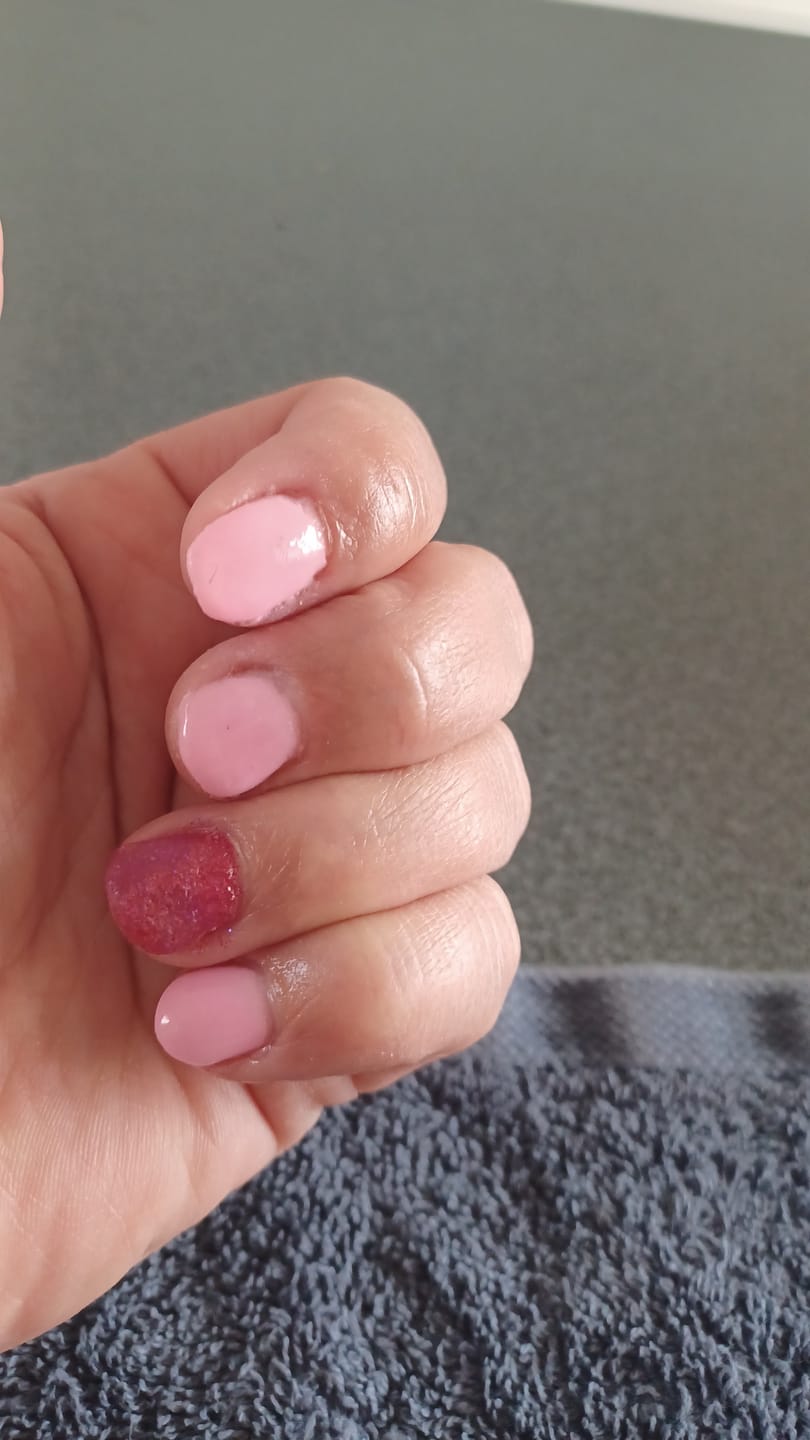 Customer photo review of Premium 4-In-1 Buffervijl