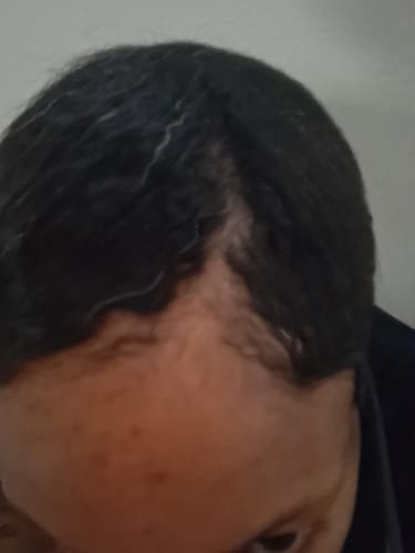 Customer photo review of Mini Herbal Hair Growth Oil