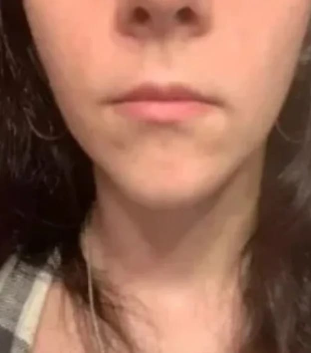 Customer photo review of Bellaré -  Lip Plumper