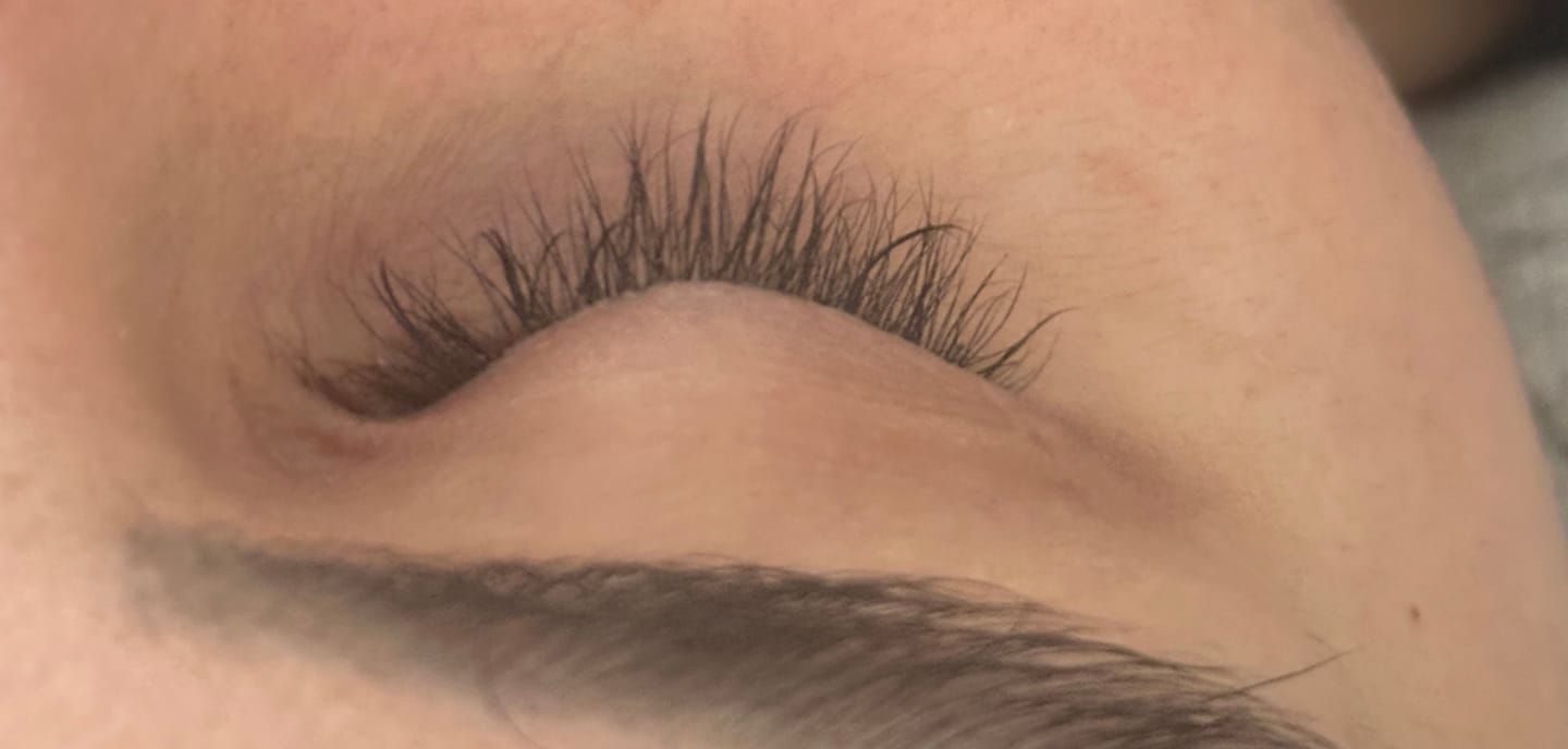 Customer photo review of NVDS Eyelash Growth Serum - Promote Healthy and Fuller Lashes