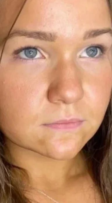 Customer photo review of Bellaré -  Lip Plumper