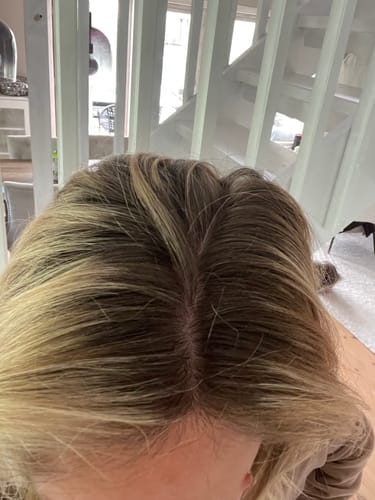 Customer photo review of Sunkissed Starter Kit