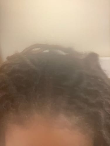 Customer photo review of Herbal Hair Growth Oil