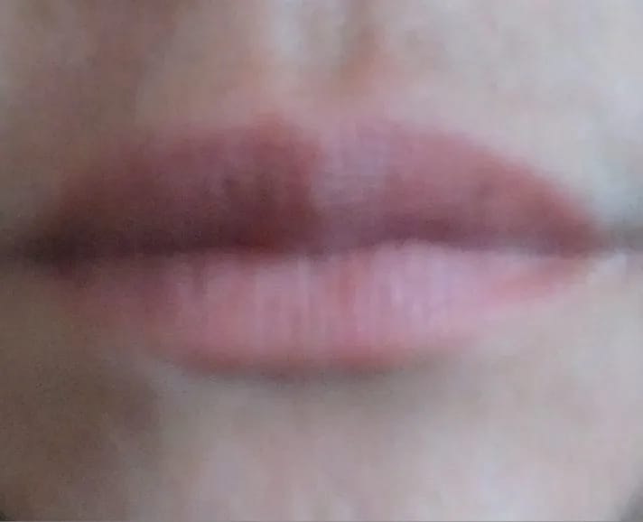 Customer photo review of Bellaré -  Lip Plumper