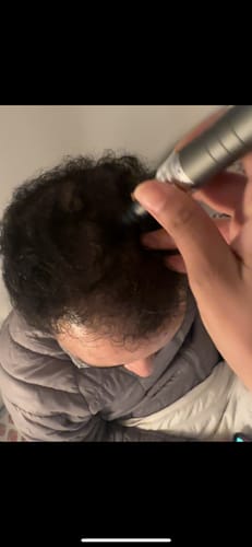 Customer photo review of Dr. Pen M8